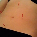 Sharon Rose - Physicians & Surgeons, Acupuncture