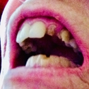 CA Central Valley Endodontics - Endodontists