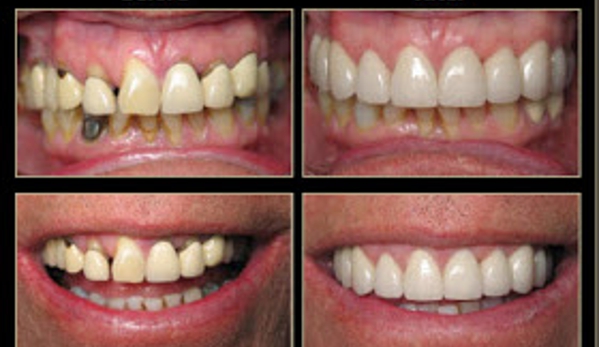 Smiles By Alex - Fountain Valley, CA. Cosmetic Dentistry Fountain Valley, CA