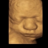 Precious Baby Peek Ultrasound gallery