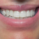 Haque, Naz, DDS - Dentists