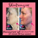 Skintrenzixs - Hair Removal