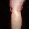 Schulman, Lee, MD Schulman Vein And Laser Center gallery
