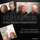 NuHair Ink. Scalp Micro Pigmentation - Hair Replacement
