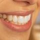 Family Dental Rego Park