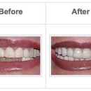 Forero Family & Implant Dentistry - Implant Dentistry