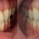 Lorton Station Dental Care - Implant Dentistry