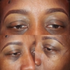 Flash Lash Eyelash Extensions gallery