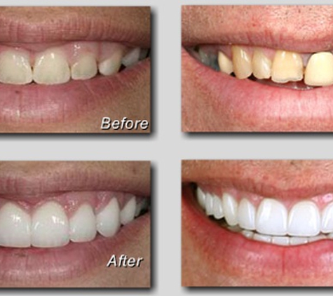Great Smiles Dental Clinic - Sandy, UT