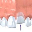 Schneider Dental Associates - Oral & Maxillofacial Surgery