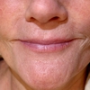 Novae Medical Aesthetics gallery