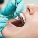 Nagy & Majestro General Dentistry - Implant Dentistry