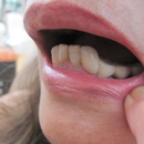 Correct Choice - Implant Dentistry