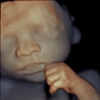 Prenatal Universe Ultrasound gallery