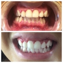 The Smile Doctor - Teeth Whitening Products & Services