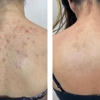 Monroe MedSpa - Orchard Park gallery