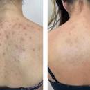 Monroe MedSpa - Orchard Park - Medical Spas