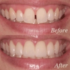 Hermosa Dental & Orthodontics