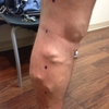 Truffles Vein Specialists gallery