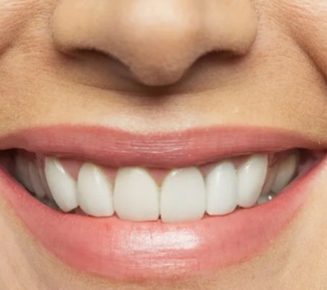 Everton Park Denture Clinic - Everton Park, QLD