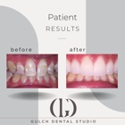 Gulch Dental Studio