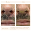 Philadelphia Facial Plastic Surgery & Medspa gallery