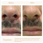 Philadelphia Facial Plastic Surgery & Medspa