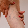 One Vein Clinic & MedSpa gallery