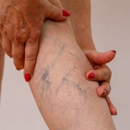 One Vein Clinic & MedSpa - Day Spas