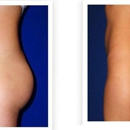 Miko Plastic Surgery - Physicians & Surgeons, Plastic & Reconstructive