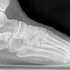 Comprehensive Foot & Ankle Center of South Jersey gallery