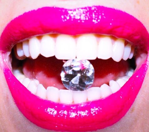 Diamond Smiles Teeth Whitening - Orlando, FL