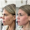 Serenity Medspa - Hair Removal