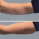 Cryo T-Shock - Nutritionists