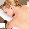 Professional Acupuncture gallery