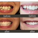 BG Dental Wellness and Cosmetic Center - Cosmetic Dentistry
