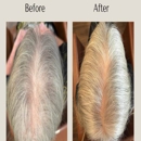 Root Revival Hair Restoration - Hair Replacement