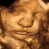 ShoMe Prenatal Imaging gallery