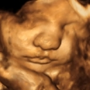 ShoMe Prenatal Imaging - Medical Imaging Services