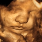 ShoMe Prenatal Imaging