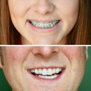 Rochester Family Orthodontics - Orthodontists