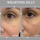 Body Sculpt Skin Laser - Skin Care