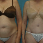 Lowe Plastic Surgery