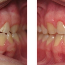 Wirtz Orthodontics - Orthodontists