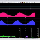 Biofeedback Therapy - Optimal State of Mind