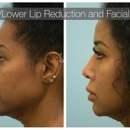 Lam Facial Plastics - Physicians & Surgeons, Plastic & Reconstructive