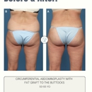 Plastic Surgery Associates - Physicians & Surgeons, Cosmetic Surgery