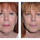 Facial Cosmetic Surgery Associates - Day Spas