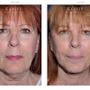 Facial Cosmetic Surgery Associates