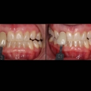 Light Touch Dental Laser and Implant Center - Dental Hygienists